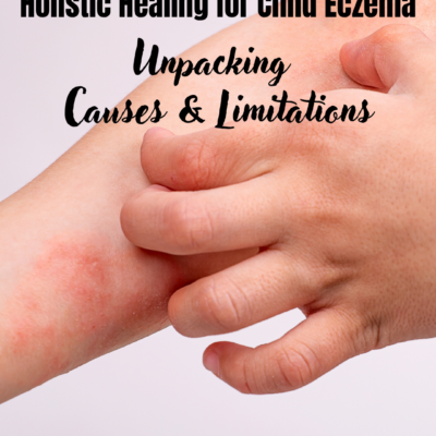Holistic Eczema Healing